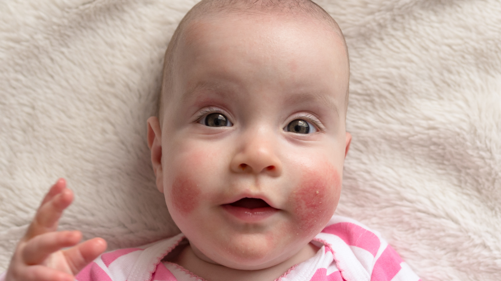 Autumn Baby Skin Care Understanding and Treating Common Issues b.box